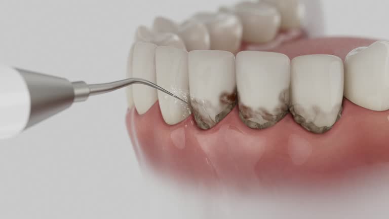 Trusted Teeth Cleaning And Checkup service in Annandale, NJ - Dentist Open Now